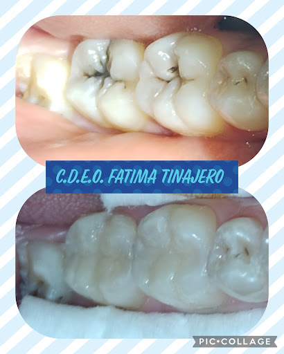 Consultorio Dental C.D. Fatima Gpe. Tinajero Perez - Thumbnail
