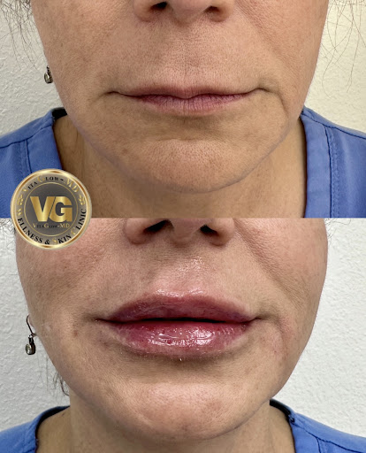 VitaGlowMD Wellness & Skin Clinic | San Jose