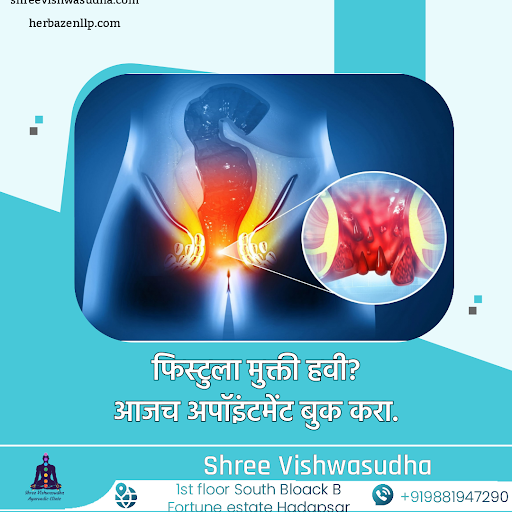 फिस्टुला (Fistula) ही एक अशी स्थिती आहे ज्यामध्ये दोन अवयव किंवा वाहिन्यांमध्ये असामान्य संबंध नि… post image