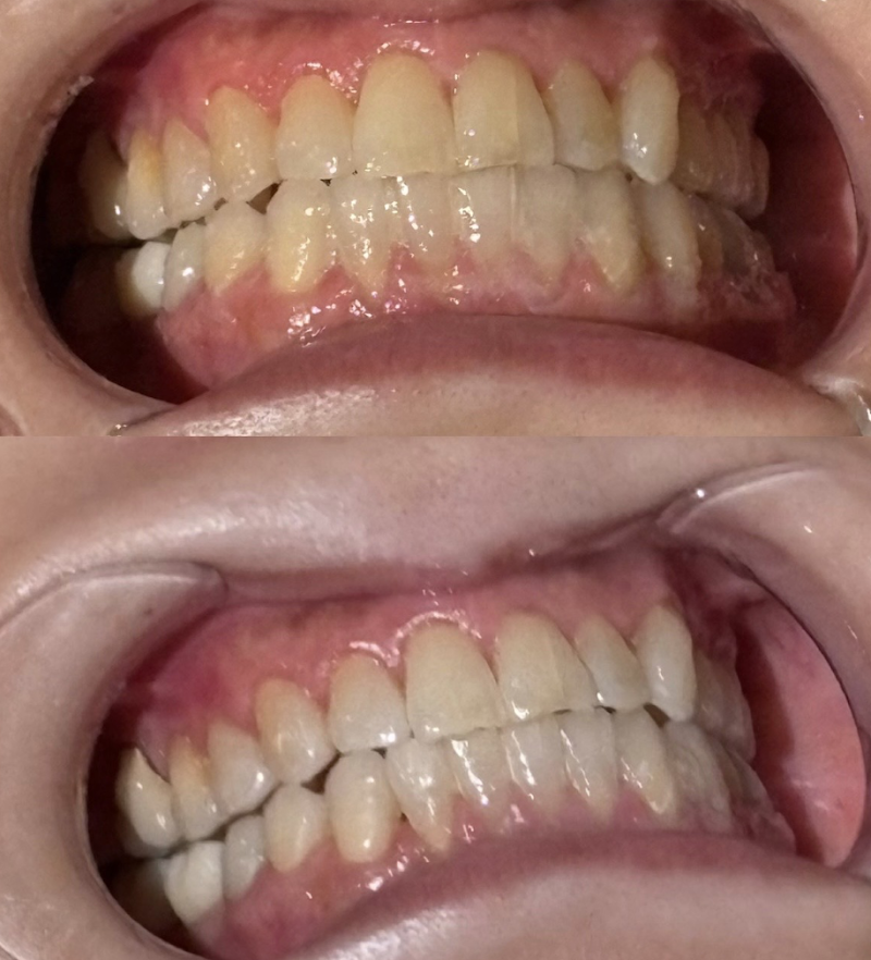 NAホワイトニング 自由が丘店