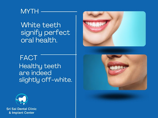 Absolutely! You've got it right! Healthy teeth can vary in shades from off-white to light yellow. post image