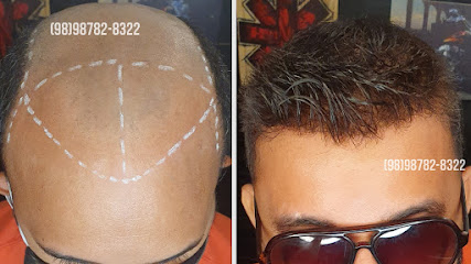 Pró Calví SLZ Reposição Capilar