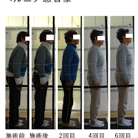 脊柱管狭窄症・ヘルニア専門 ときわバランス整体