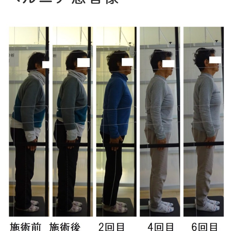 脊柱管狭窄症・ヘルニア専門 ときわバランス整体