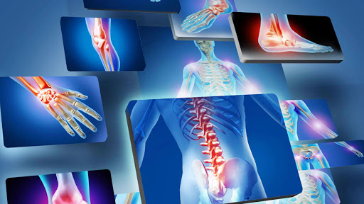Traumatologo Ortopedista Dr. Arceo Tijuana