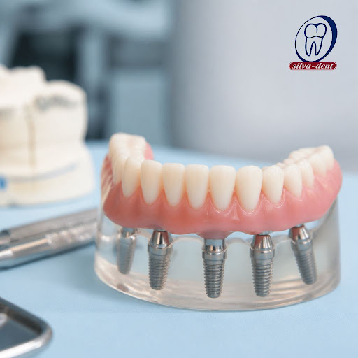 Missing several teeth can affect your confidence, chewing, and overall health. At Silva Dent Mult… post image