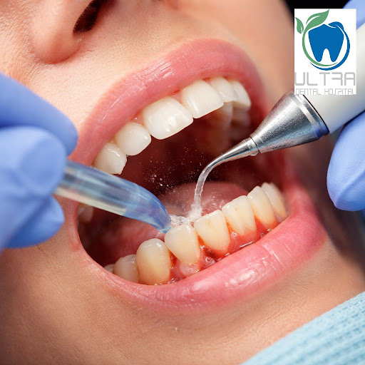 Struggling with bleeding gums, bad breath or loose teeth? At Ultra Dental hospital and implant ce… post image