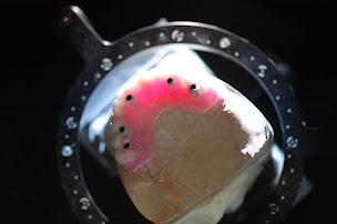 Photo n°17 de iClinique - Clinique d'implantologie dentaire à Courbevoie (Centre de prothèses dentaires)