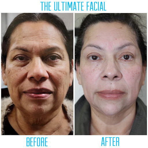 The Ultimate Facial - Thumbnail