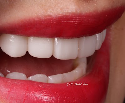Photos of GiO Dental Care & Clinic BABARSARI