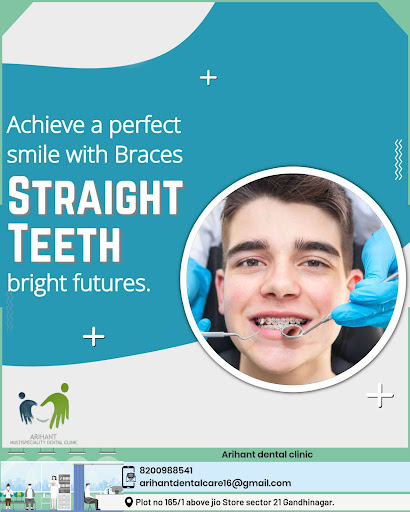 Expert clear aligners and braces in Gandhinagar. post image