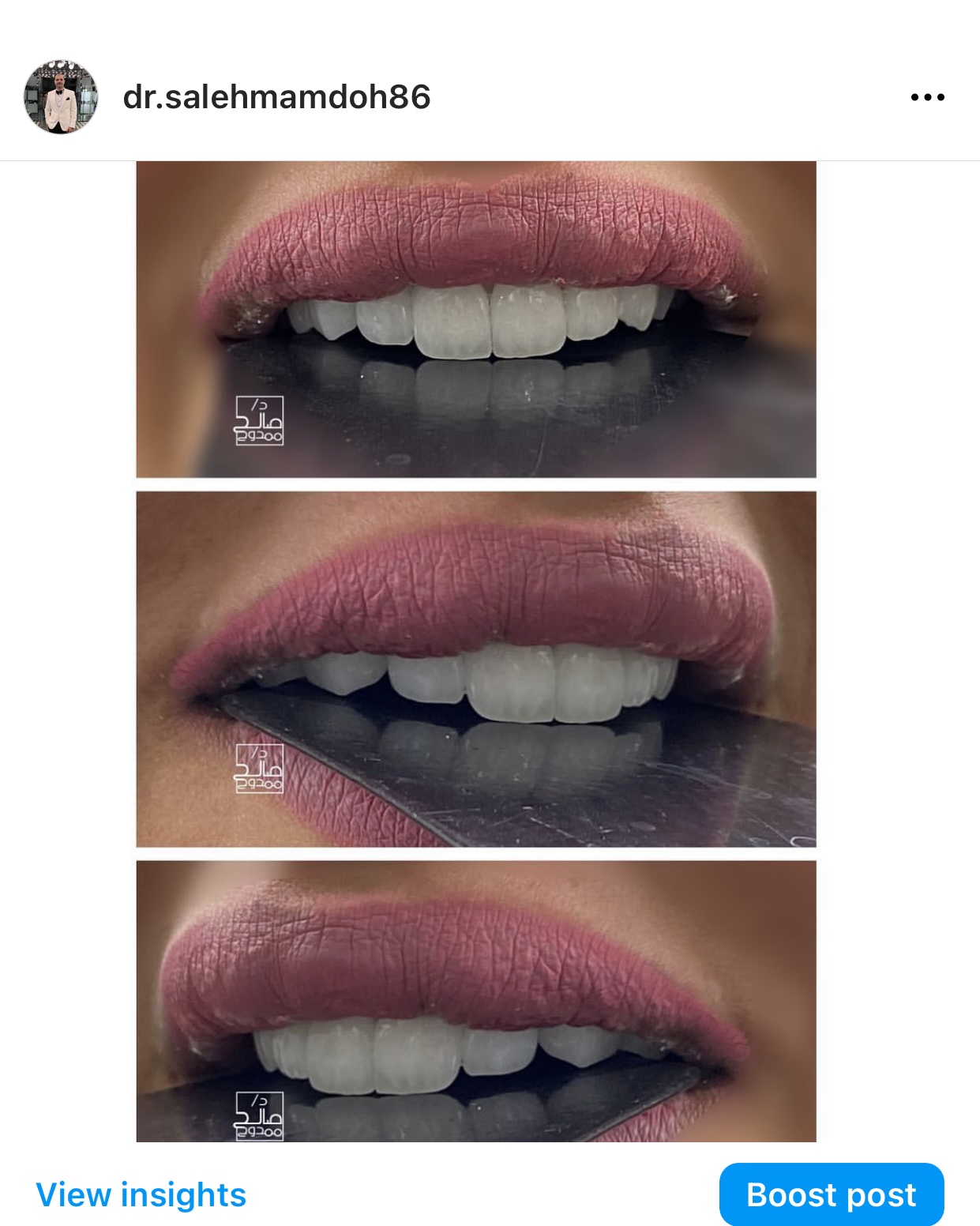 عيادة د.توث DR.TOOTH CLINIC - صورة 3