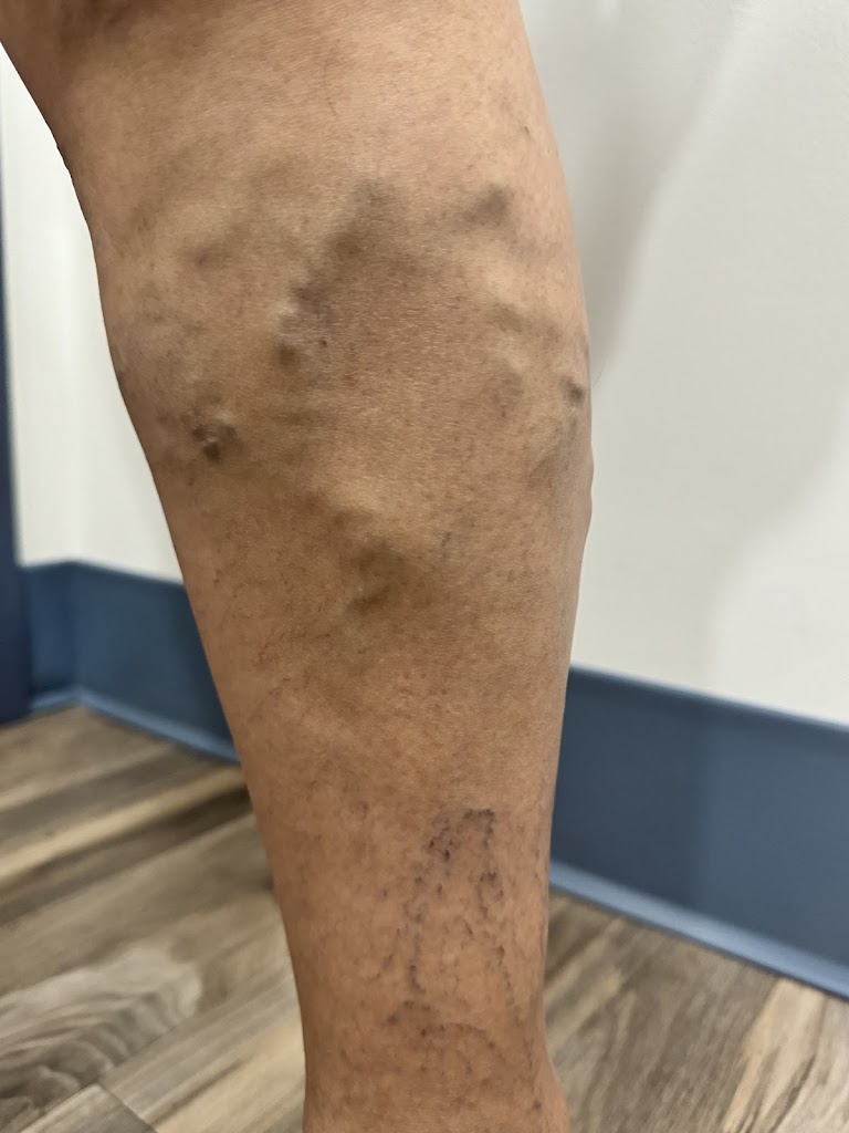 Loop Medical Center Pain Management And Varicose Vein Doctor In Chicago