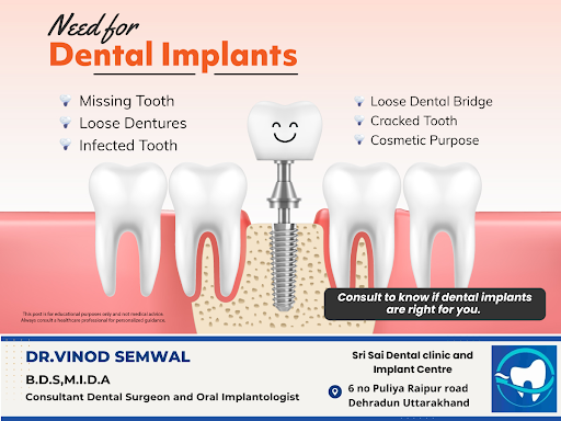 Patients choose dental implants to replace one or more missing teeth. They address functional iss… post image