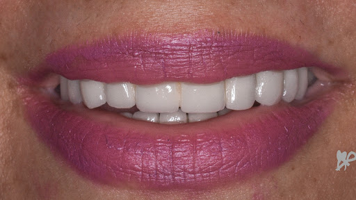 Unident Dental Center - صورة 5