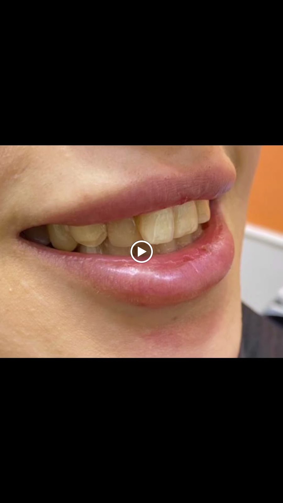 Just Smile Dental Clinic عيادة جست سمايل لطب الأسنان - صورة 4