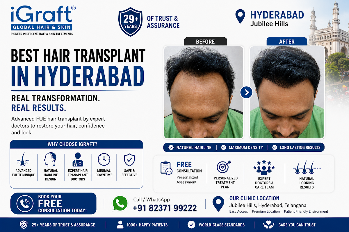 Hair Transplant in Hyderabad | iGraft Global Hair & Skin Looking for…