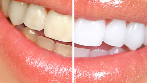 Rosehill Dental Practice - Thumbnail