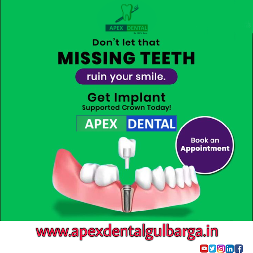 #Implant  post image