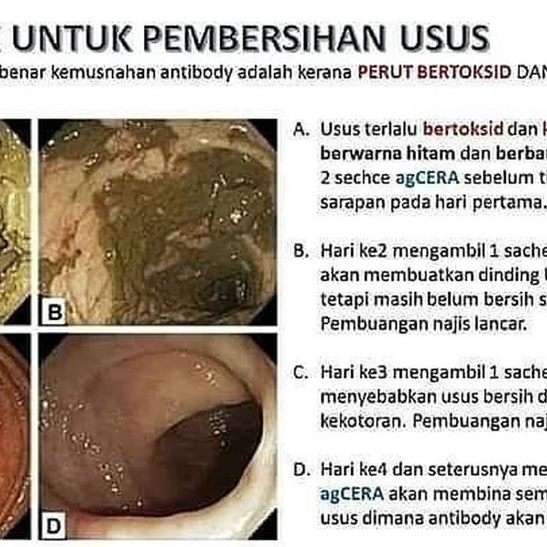 Kenapa najis berwarna hitam