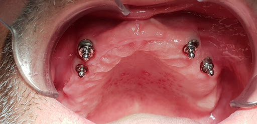 TECNODENTAL di Montagnoli Fabio LAB.PROTESI DENTALE - Thumbnail