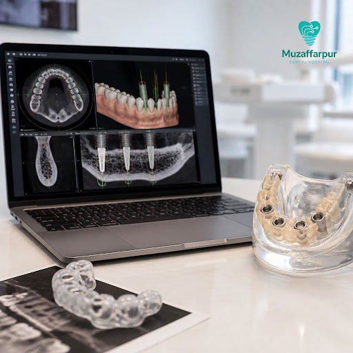Curious how modern dental implants are planned so precisely? At Muzaffarpur dental hospital, we u… post image