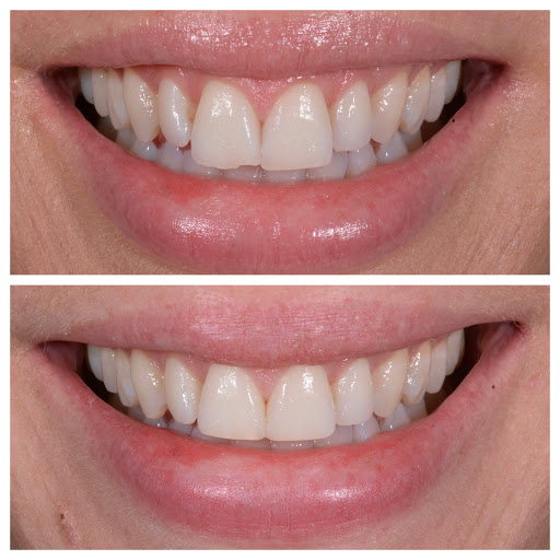 Best Western Dental Centre-Dr Nathan Le B.D.S - Thumbnail