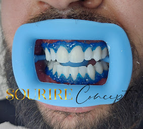 Photo n°3 de Smile Concept à Grenoble ()