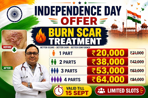 Independence day off er on Burn Scar Combination Treatment post image