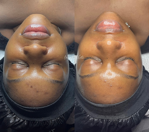 Vercetti Vista Skin Aesthetics