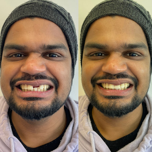 : Dental Implants Starting from ₹15,000 Only post image