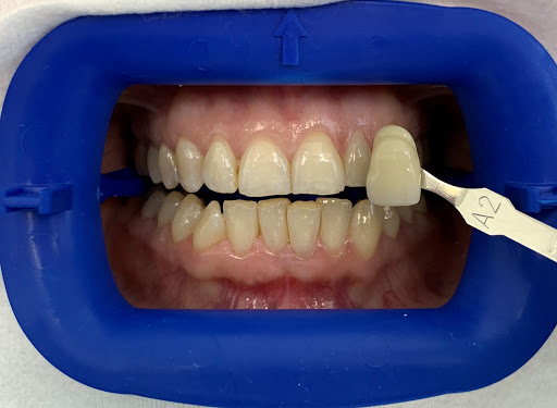 Orion's Dental: Dentist in Springvale - Thumbnail