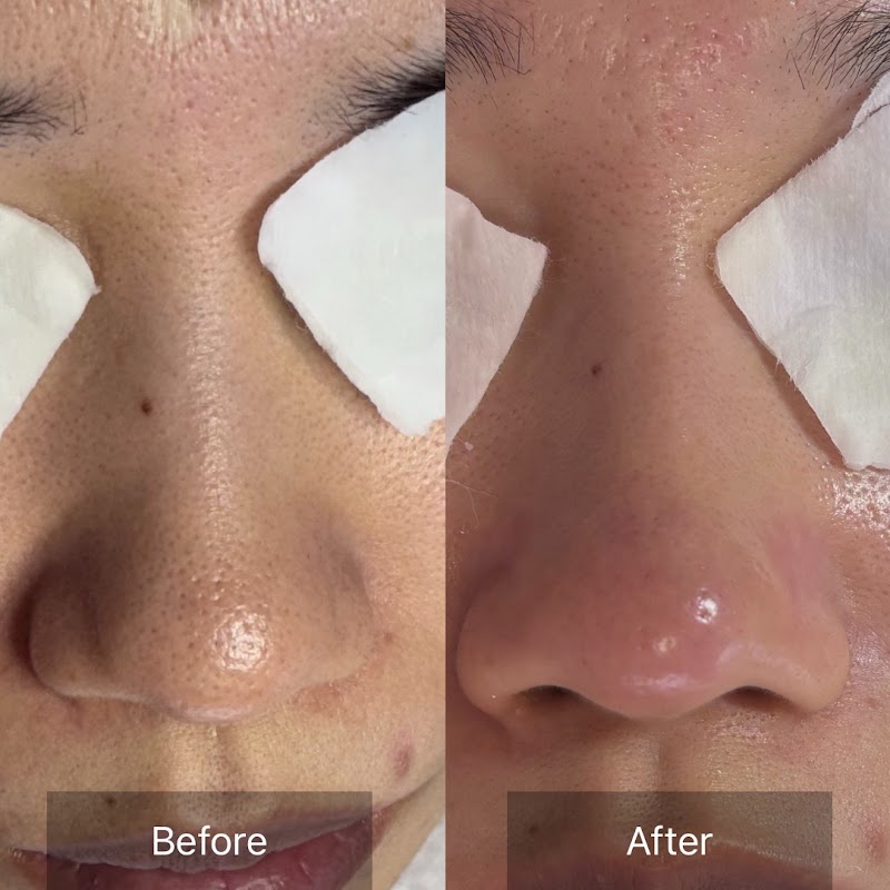 毛穴艶肌専門サロンカラン