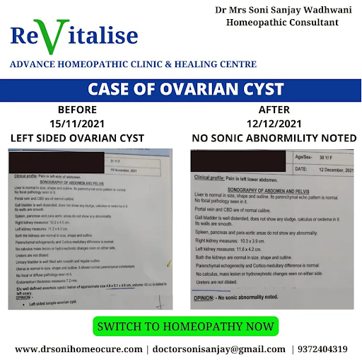 For More details Visit post image