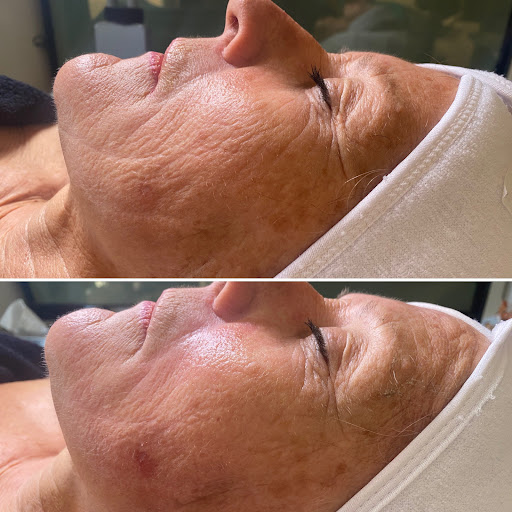 Form AVANA Massage - Thumbnail