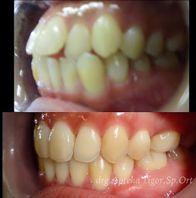 Photos of Dokter gigi spesialis kawat gigi / drg. Apreka Tigor , Sp.Orth / behel / RS Kasih Ibu Solo