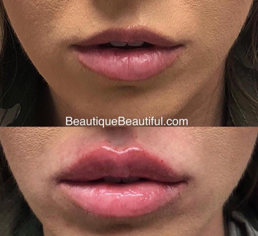 Beautique Medical Anti-Aging