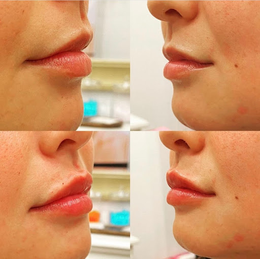 You Aesthetics - Medical Spa