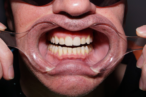 Gateway Dental Health - Thumbnail