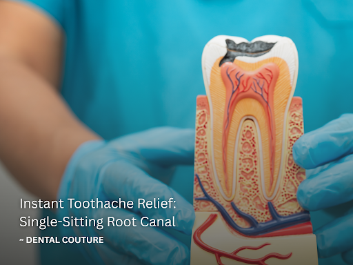 Painless Single-Sitting Root Canal | Dental Couture post image