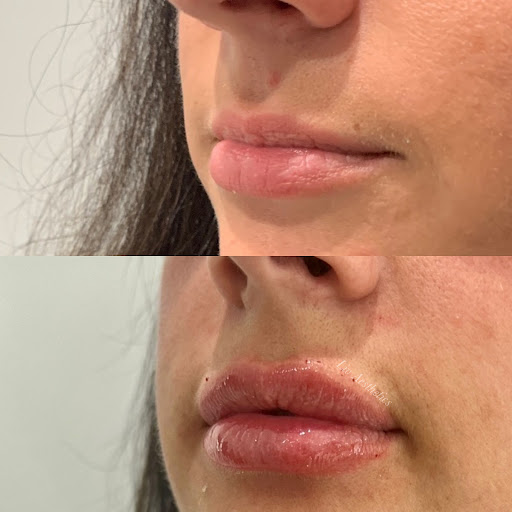 Liv Aesthetics Medical Spa