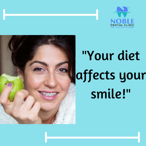 Did you know that what you eat plays a huge role in your oral health? Sugary snacks and acidic dr… post image