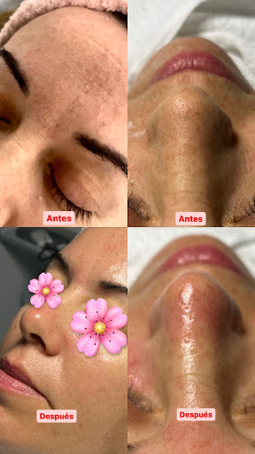 Centro de Depilación y Estética Oni Esthetic No+vello - Thumbnail