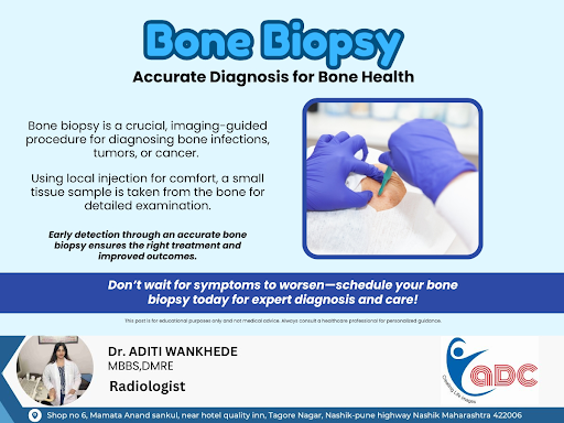 A bone biopsy is the most effective way to diagnose bone conditions such as infections, tumors, o… post image