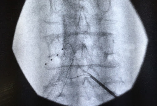 Stuart Hough, MD - Visual