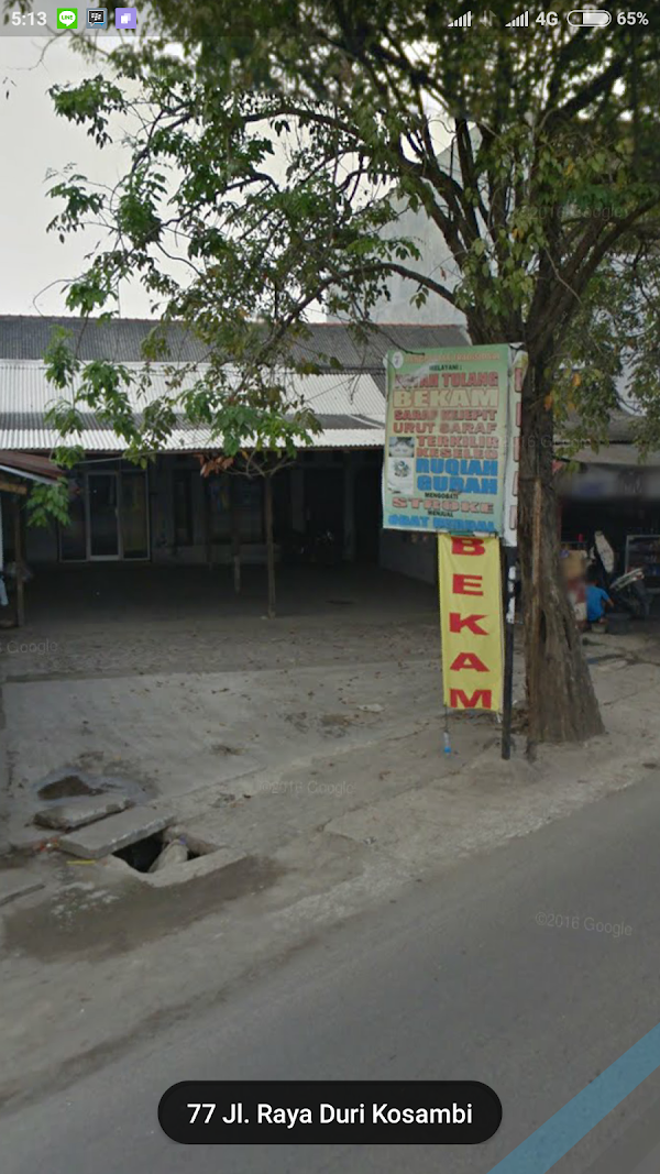 Terapi Bekam Herbal Dan Patah Tulang Darussyifa