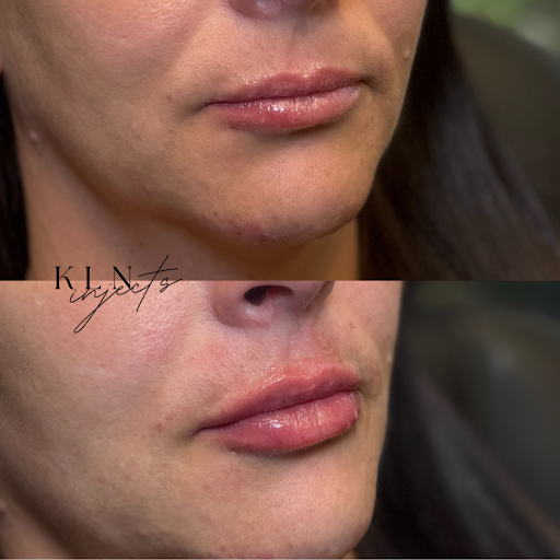 FACE/FIT Aesthetics & Wellness Shreveport