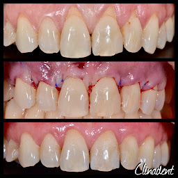 Photo n°24 de Clinadent - Centre dentaire Paris 16 Victor Hugo à Paris (Orthodontiste)