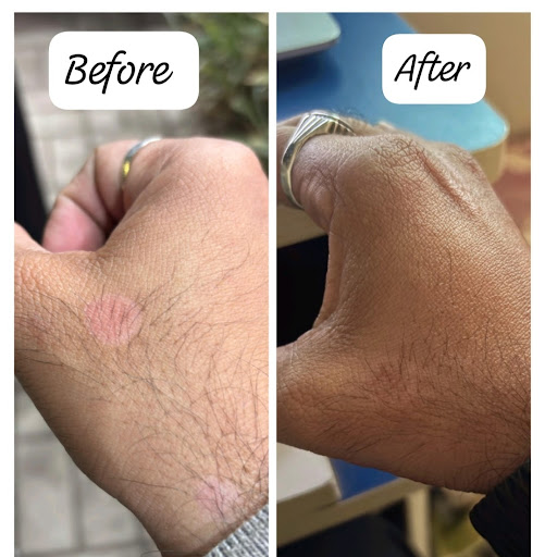 Skin Infection post image