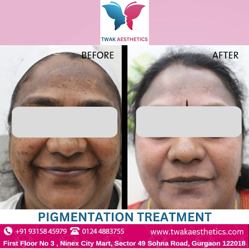 Consult our experts today at TWAK AESTHETICS . 